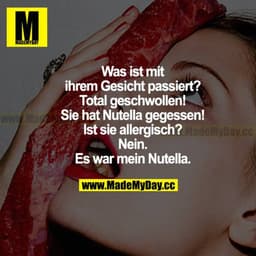 Was ist mit ihrem Gesicht passiert? Total geschwollen! Sie hat Nutella gegessen! Ist sie allergisch? Nein. Es war mein N