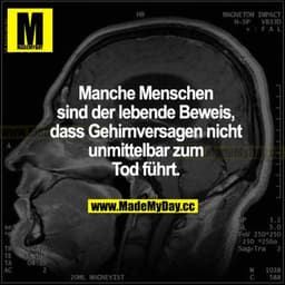 Manche Menschen sind der lebende Beweis, dass Gehirnversagen nicht unmittelbar zum Tod führt.