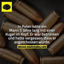 In Polen lebte ein Mann 5 Jahre lang mit einer Kugel im Kopf. Er war betrunken und hatte vergessen, dass er angeschossen