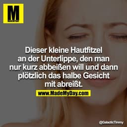 Dieser kleine Hautfitzel an der Unterlippe, den man nur kurz abbeißen will und dann plötzlich das halbe Gesicht mit abre
