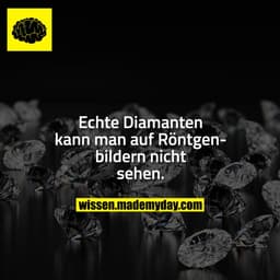 Echte Diamanten kann man auf Röntgenbildern nicht sehen.