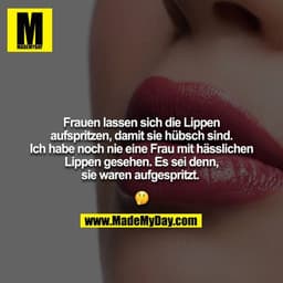 Frauen lassen sich die Lippen aufspritzen, damit sie hübsch sind. Ich habe noch nie eine Frau mit hässlichen Lippen gese