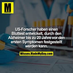 US-Forscher haben einen Bluttest entwickelt, durch den Alzheimer bis zu 20 Jahre vor den ersten Symptomen festgestellt w