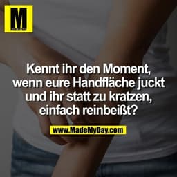 Kennt ihr den Moment, wenn eure Handfläche juckt und ihr statt zu kratzen, einfach reinbeißt?