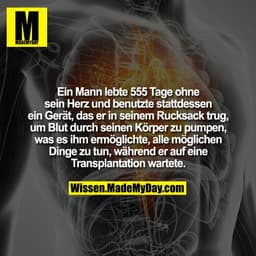 Ein Mann lebte 555 Tage ohne sein Herz und benutzte stattdessen ein Gerät, das er in seinem Rucksack trug, um Blut durch